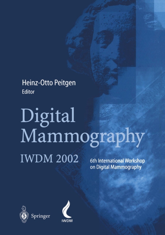 Digital Mammography (e-bog) af -