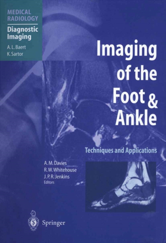 Imaging of the Foot & Ankle (e-bog) af -