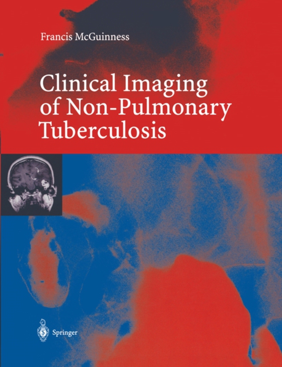 Clinical Imaging in Non-Pulmonary Tuberculosis (e-bog) af McGuinness, Francis E.