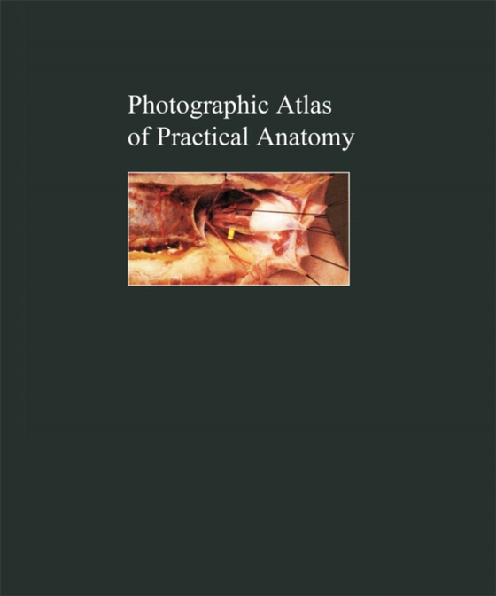 Photographic Atlas of Practical Anatomy II (e-bog) af Thiel, Walter