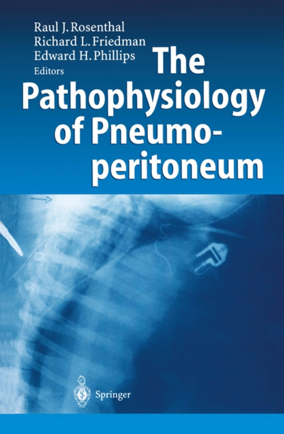 Pathophysiology of Pneumoperitoneum