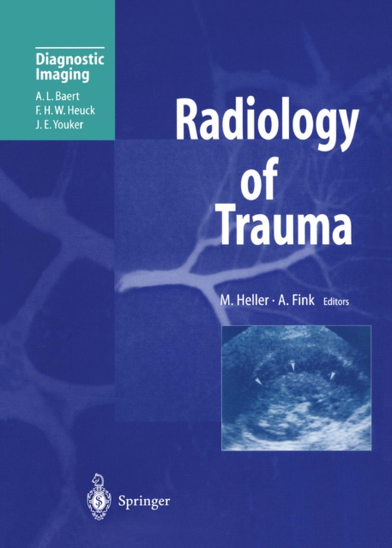 Radiology of Trauma (e-bog) af -