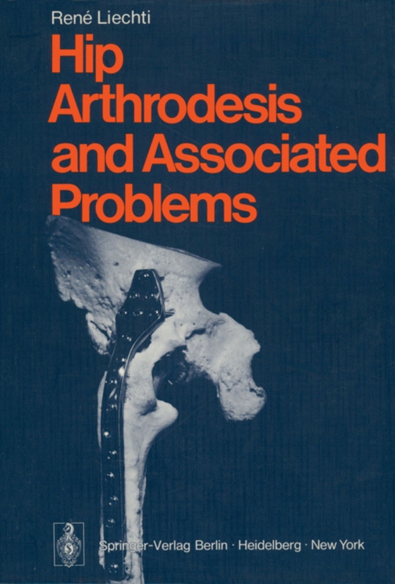 Hip Arthrodesis and Associated Problems (e-bog) af Liechti, R.