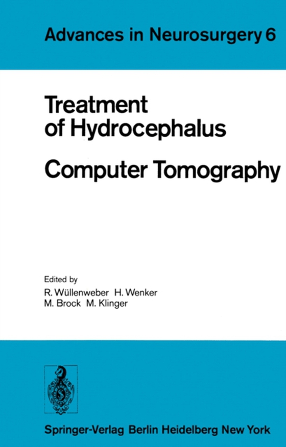 Treatment of Hydrocephalus Computer Tomography (e-bog) af -