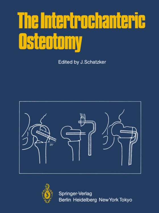 Intertrochanteric Osteotomy (e-bog) af -