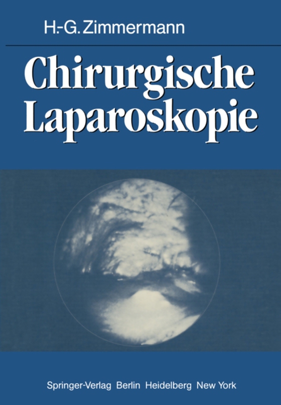 Chirurgische Laparoskopie (e-bog) af Zimmermann, H.-G.