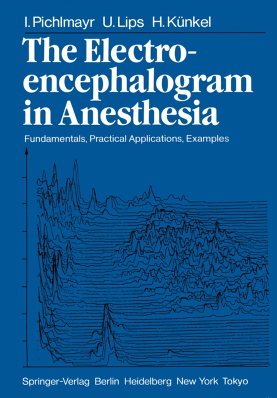 Electroencephalogram in Anesthesia