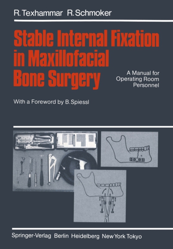 Stable Internal Fixation in Maxillofacial Bone Surgery (e-bog) af Schmoker, R.