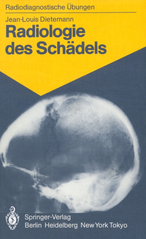 Radiologie des Schädels (e-bog) af Dietemann, J.-L.