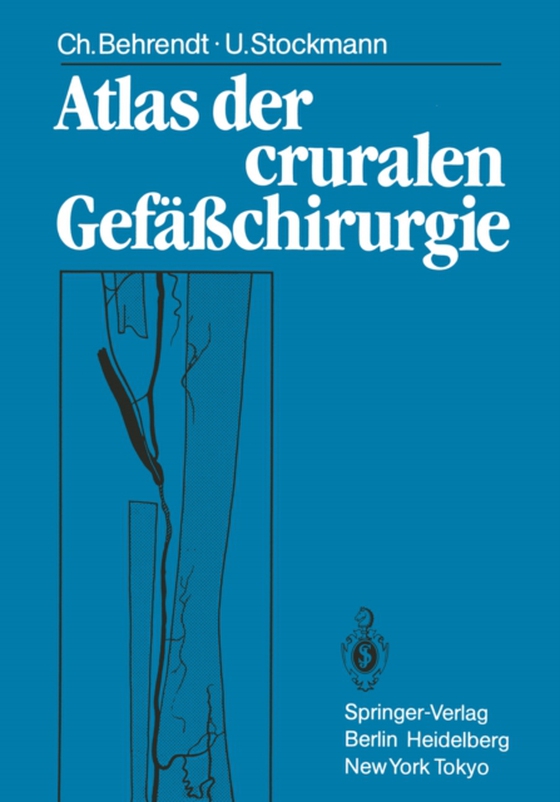 Atlas der cruralen Gefäßchirurgie (e-bog) af Stockmann, Ulf