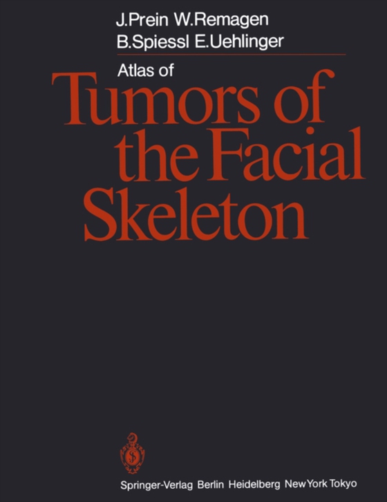 Atlas of Tumors of the Facial Skeleton (e-bog) af Uehlinger, Erwin