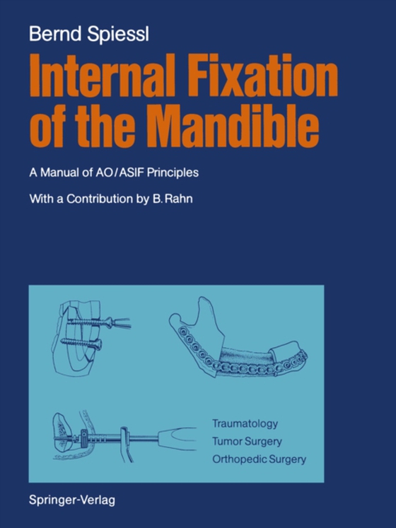 Internal Fixation of the Mandible (e-bog) af Spiessl, Bernd