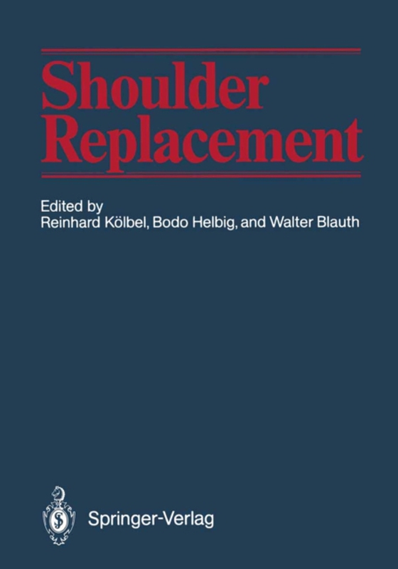 Shoulder Replacement (e-bog) af -