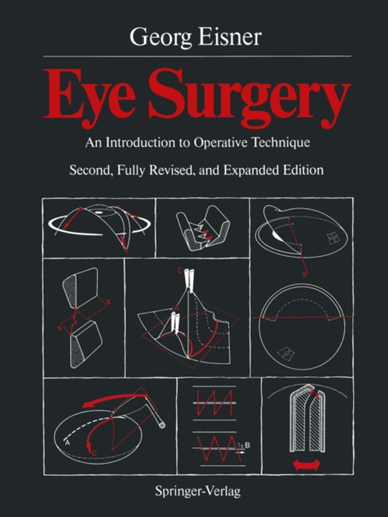 Eye Surgery (e-bog) af Eisner, Georg