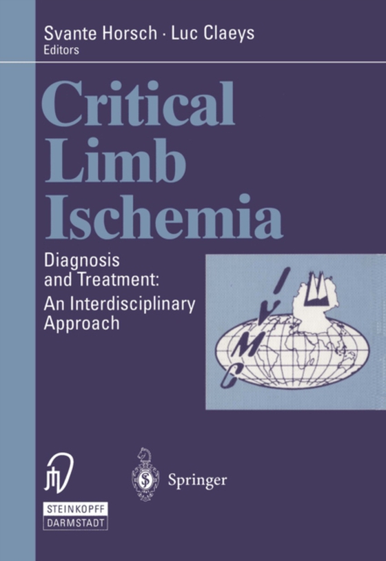 Critical Limb Ischemia (e-bog) af -