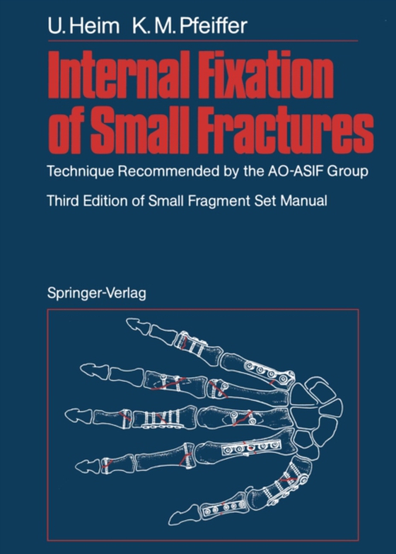 Internal Fixation of Small Fractures (e-bog) af Pfeiffer, Karl M.