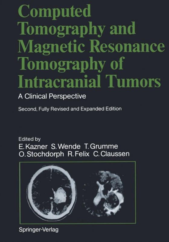 Computed Tomography and Magnetic Resonance Tomography of Intracranial Tumors (e-bog) af Wende, S.