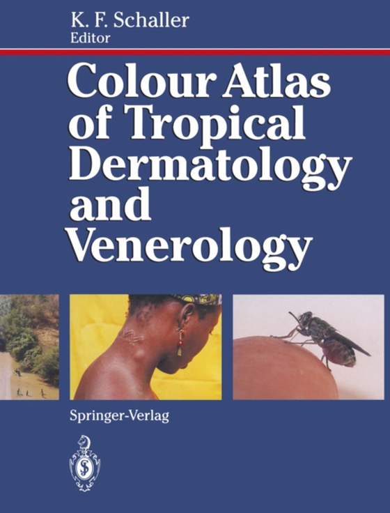 Colour Atlas of Tropical Dermatology and Venerology (e-bog) af -