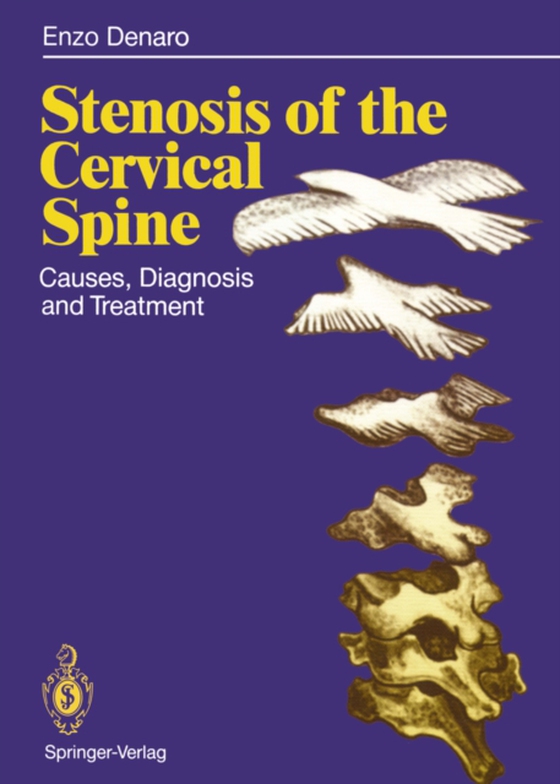 Stenosis of the Cervical Spine (e-bog) af Denaro, Vincenzo