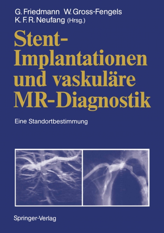 Stent-Implantationen und vaskuläre MR-Diagnostik (e-bog) af -