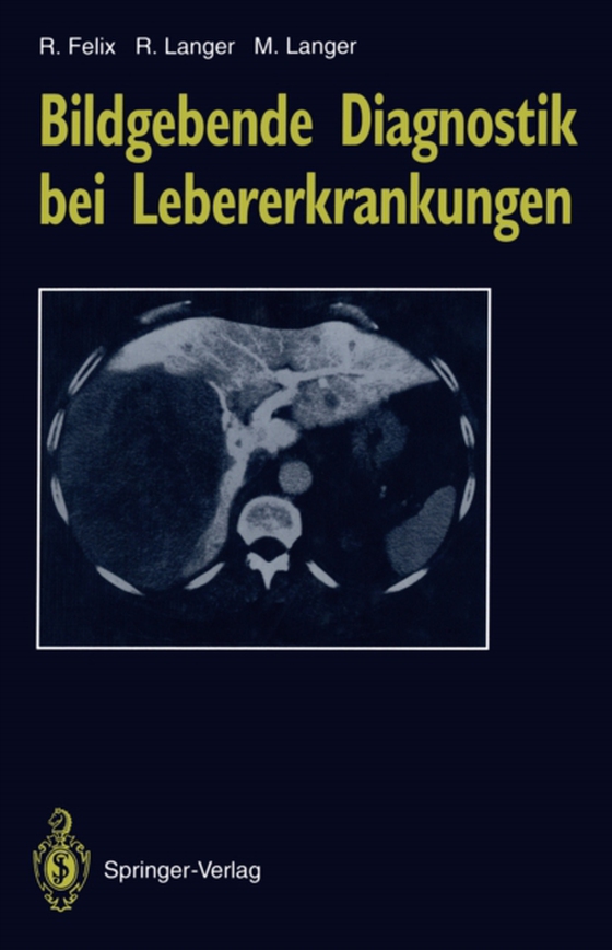 Bildgebende Diagnostik bei Lebererkrankungen (e-bog) af Langer, Mathias