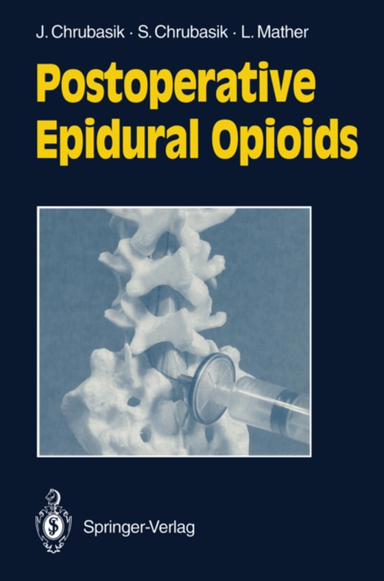 Postoperative Epidural Opioids (e-bog) af Mather, Laurence