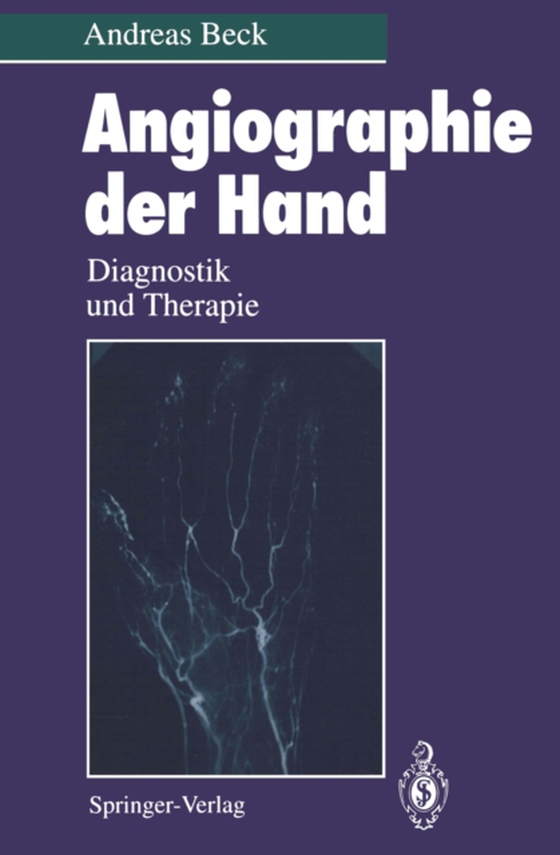 Angiographie der Hand (e-bog) af Beck, Andreas