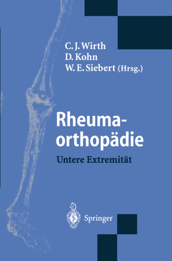 Rheumaorthopädie — Untere Extremität (e-bog) af -