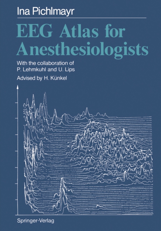 EEG Atlas for Anesthesiologists (e-bog) af Pichlmayr, Ina