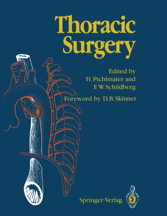 Thoracic Surgery (e-bog) af -