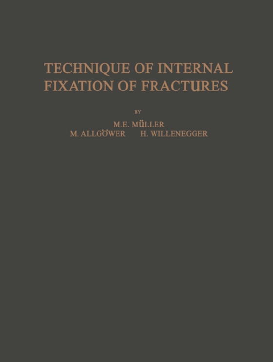 Technique of Internal Fixation of Fractures (e-bog) af Weber, B. G.