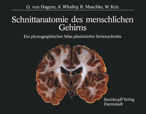 Schnittanatomie des menschlichen Gehirns (e-bog) af Kriz, W.