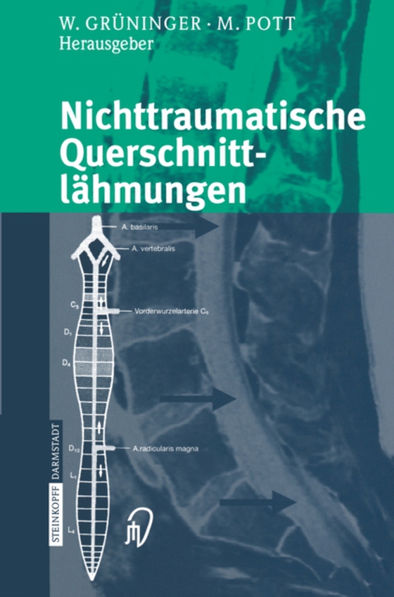 Nichttraumatische Querschnittlähmungen (e-bog) af -