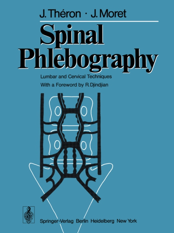 Spinal Phlebography (e-bog) af Moret, J.