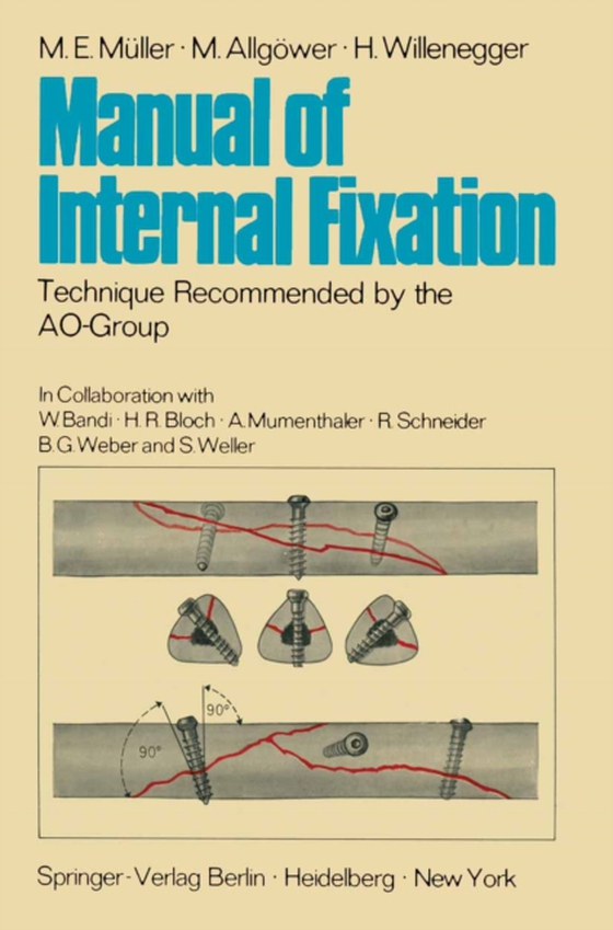 Manual of Internal Fixation (e-bog) af Willenegger, H.