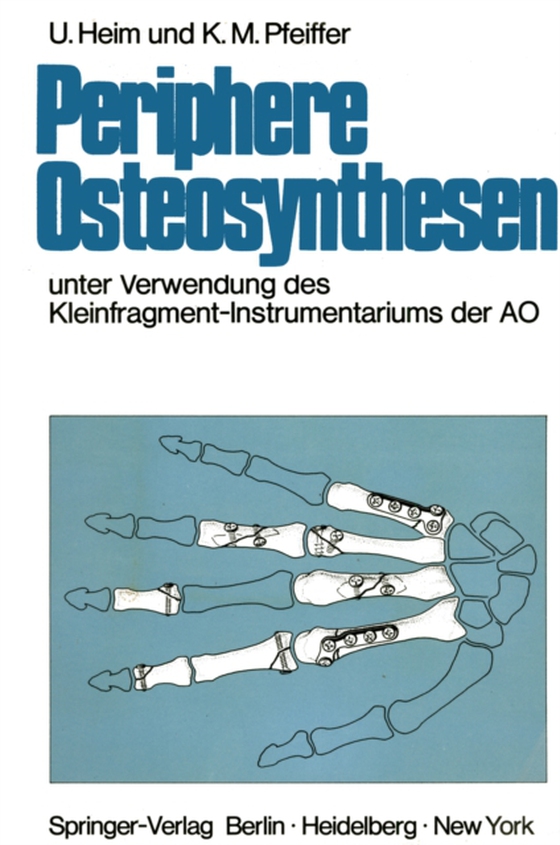 Periphere Osteosynthesen (e-bog) af Pfeiffer, Karl M.