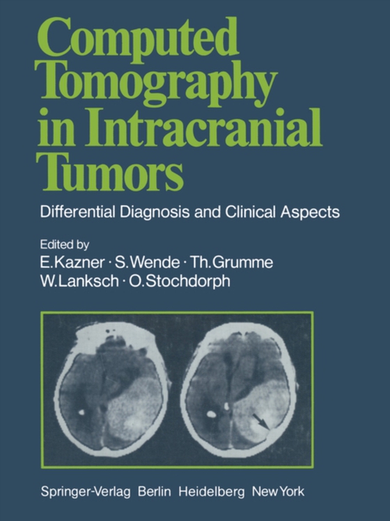 Computed Tomography in Intracranial Tumors (e-bog) af Wende, S.