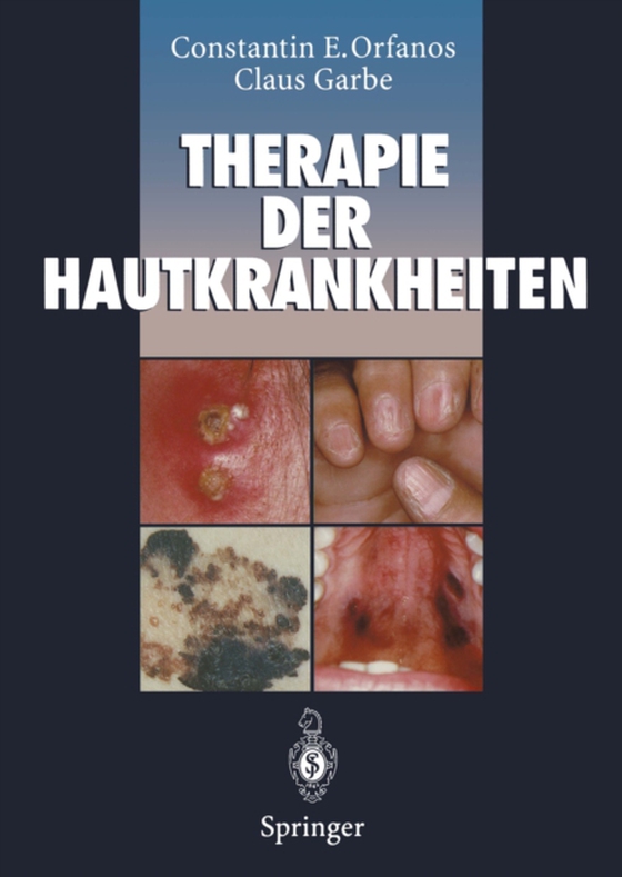 Therapie der Hautkrankheiten (e-bog) af Garbe, Claus