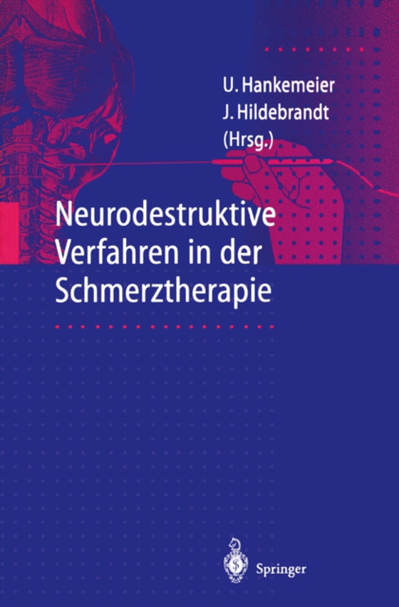 Neurodestruktive Verfahren in der Schmerztherapie (e-bog) af -