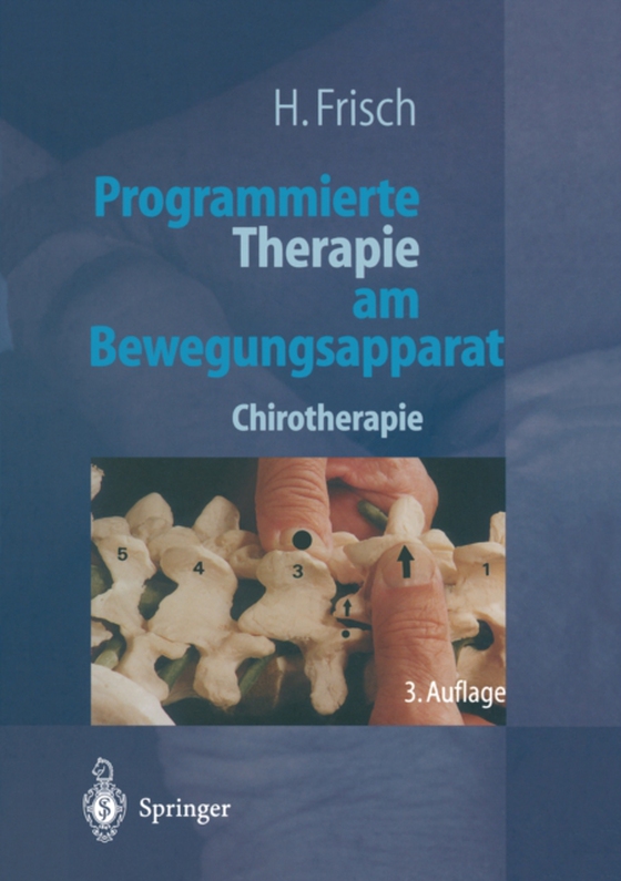 Programmierte Therapie am Bewegungsapparat (e-bog) af Frisch, Herbert