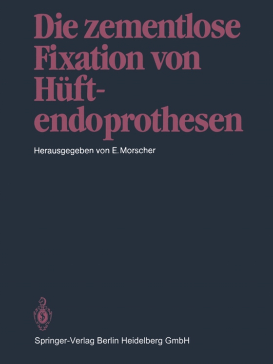 Die zementlose Fixation von Hüftendoprothesen (e-bog) af -