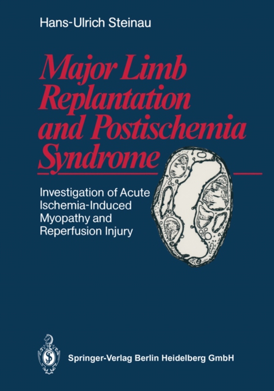 Major Limb Replantation and Postischemia Syndrome (e-bog) af Steinau, Hans-Ulrich