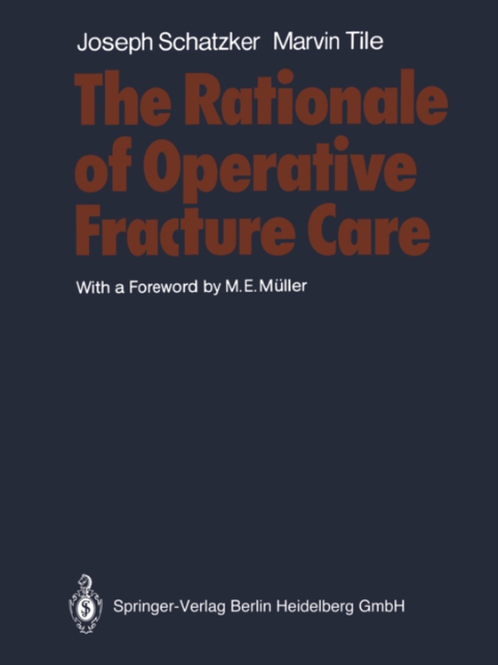 Rationale of Operative Fracture Care (e-bog) af Tile, Marvin