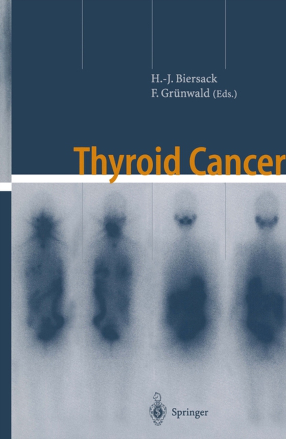 Thyroid Cancer (e-bog) af -