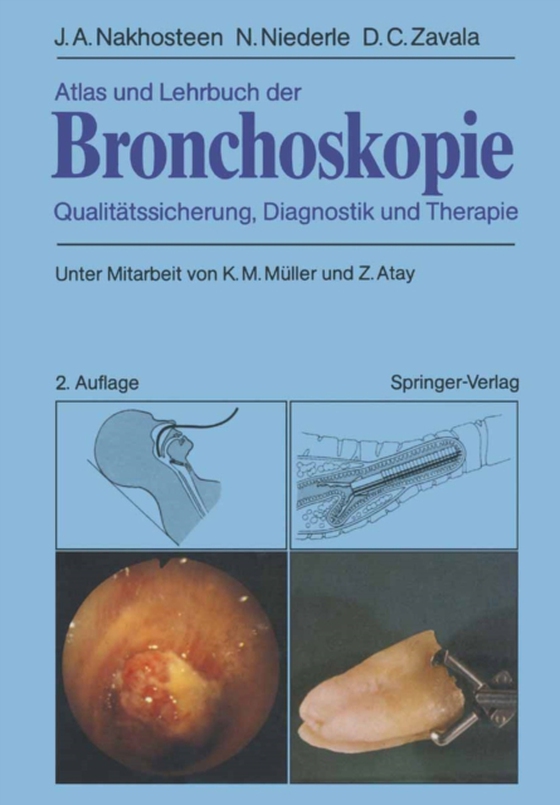 Atlas und Lehrbuch der Bronchoskopie (e-bog) af Zavala, Donald C.