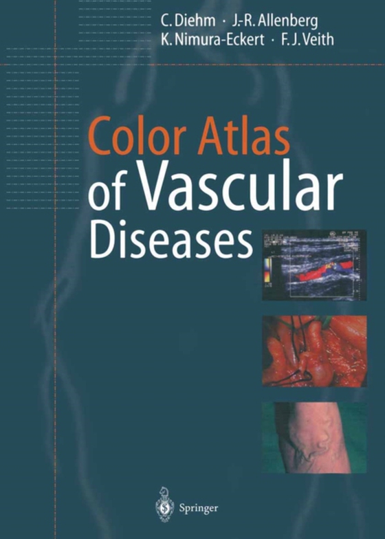 Color Atlas of Vascular Diseases (e-bog) af Veith, F.J.