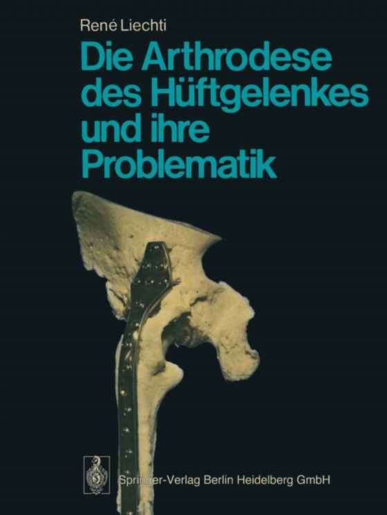 Die Arthrodese des Hüftgelenkes und ihre Problematik (e-bog) af Liechti, R.