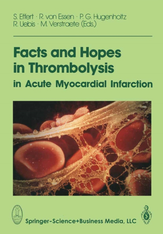 Facts and Hopes in Thrombolysis in Acute Myocardial Infarction (e-bog) af -