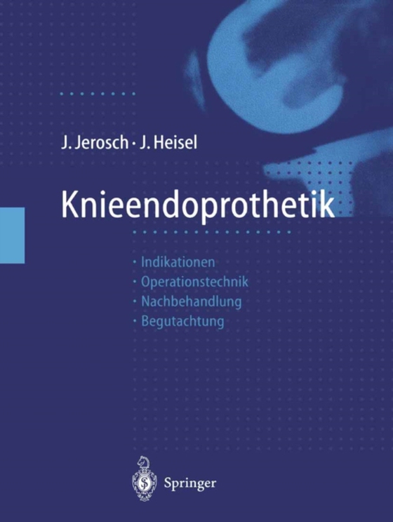 Knieendoprothetik