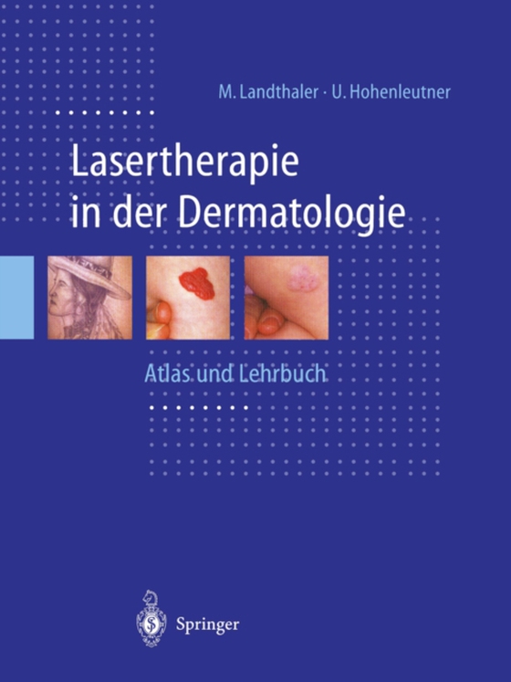 Lasertherapie in der Dermatologie (e-bog) af Hohenleutner, Ulrich